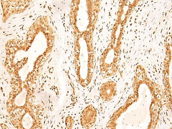 ZNF471 Antibody