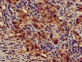 Polyclonal Rabbit anti-Human ATG14 Antibody (IHC, IF)