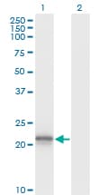 Monoclonal Mouse anti-Human VHL / Von Hippel Lindau Antibody (clone 1G12, IF, WB)