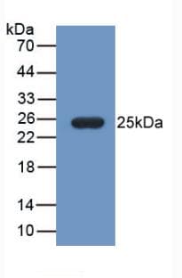 FBLN1 / Fibulin 1 Antibody