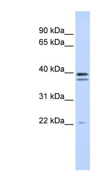 RABGGTB Antibody (C-Terminus)