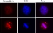 Acetyl-Lysine Antibody (clone 15G10)