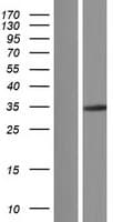 HGF / Hepatocyte Growth Factor Protein (Over-Expression Lysate Myc-DDK (Flag))