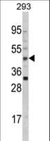 AADAC Antibody (aa273-300)