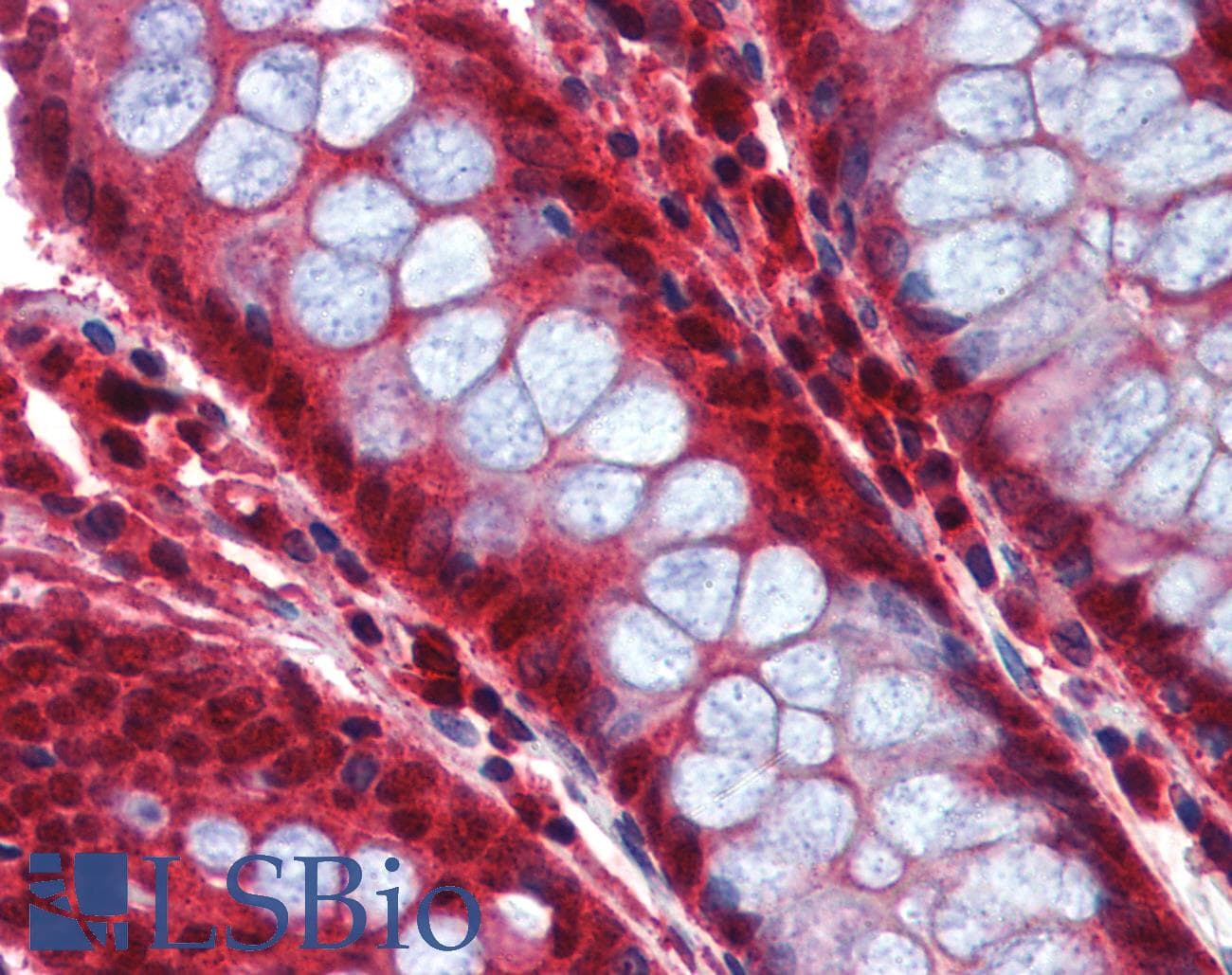 CASP8 / Caspase 8 Antibody