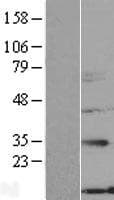 NXNL2 Protein (Over-Expression Lysate Myc-DDK (Flag))