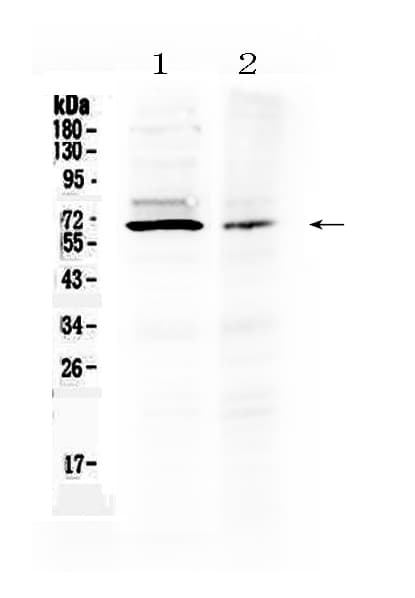 AMH / Anti-Mullerian Hormone Antibody