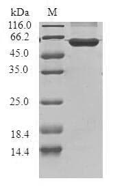 Human CCND3 / Cyclin D3 Protein (Recombinant GST, N-terminus)