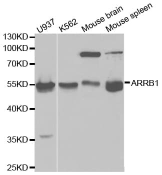 Polyclonal Rabbit anti-Human ARRB1 / Beta Arrestin 1 Antibody (IHC, IF, WB)