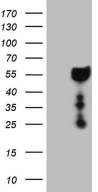 DMRT1 Antibody (aa1-210, clone 2H1, Carrier-free)