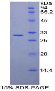 Mouse Transaldolase Protein (Recombinant His-T7)