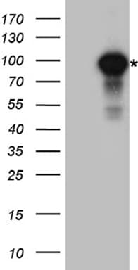 IKBKB / IKK2 / IKK Beta Antibody