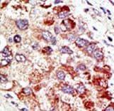CBLC Antibody (aa1-30)