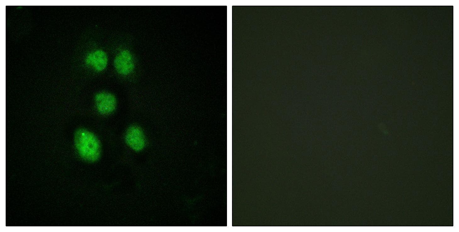 VAV1 / VAV Antibody (Ab-160)