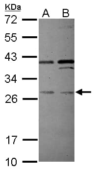 PLEKHF2 Antibody