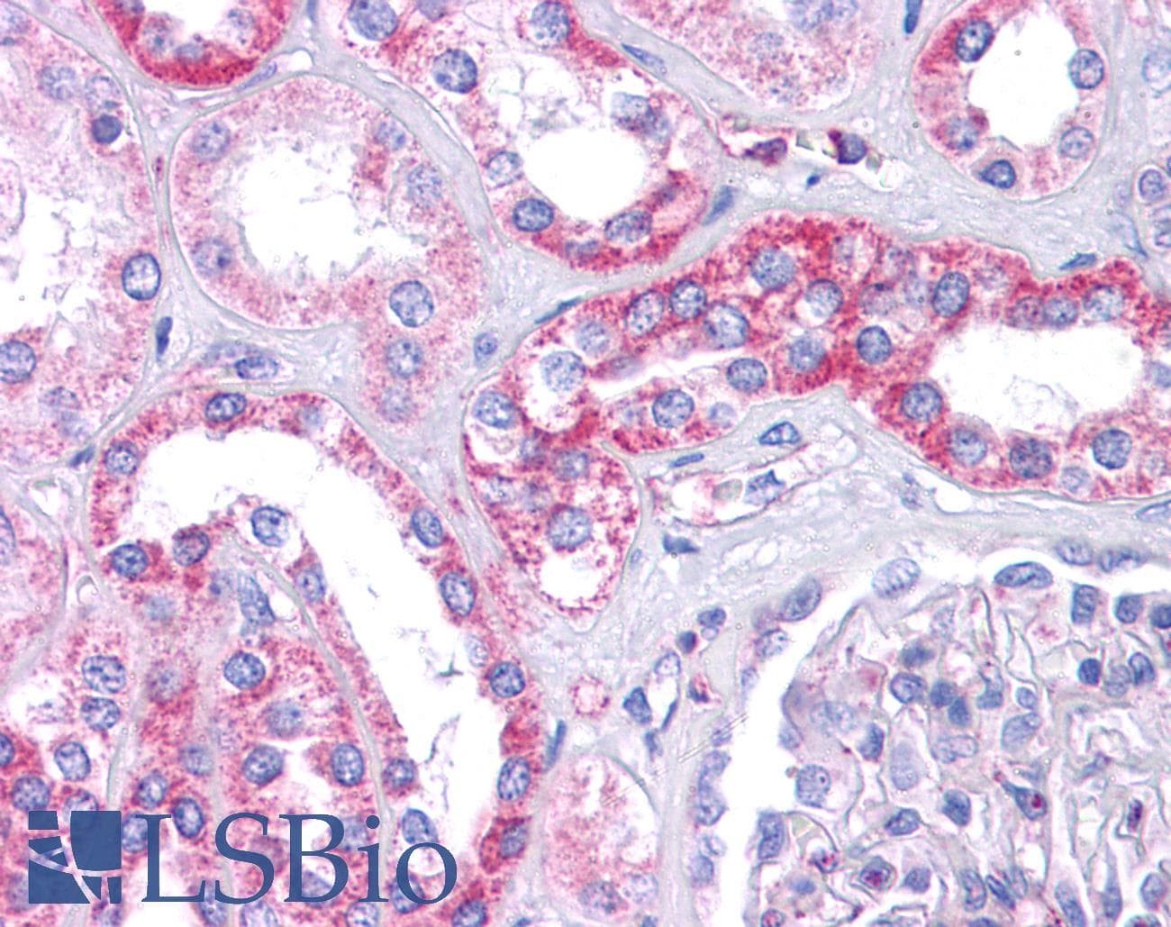 IHC-plus™ E6TP1 / SIPA1L1 Antibody
