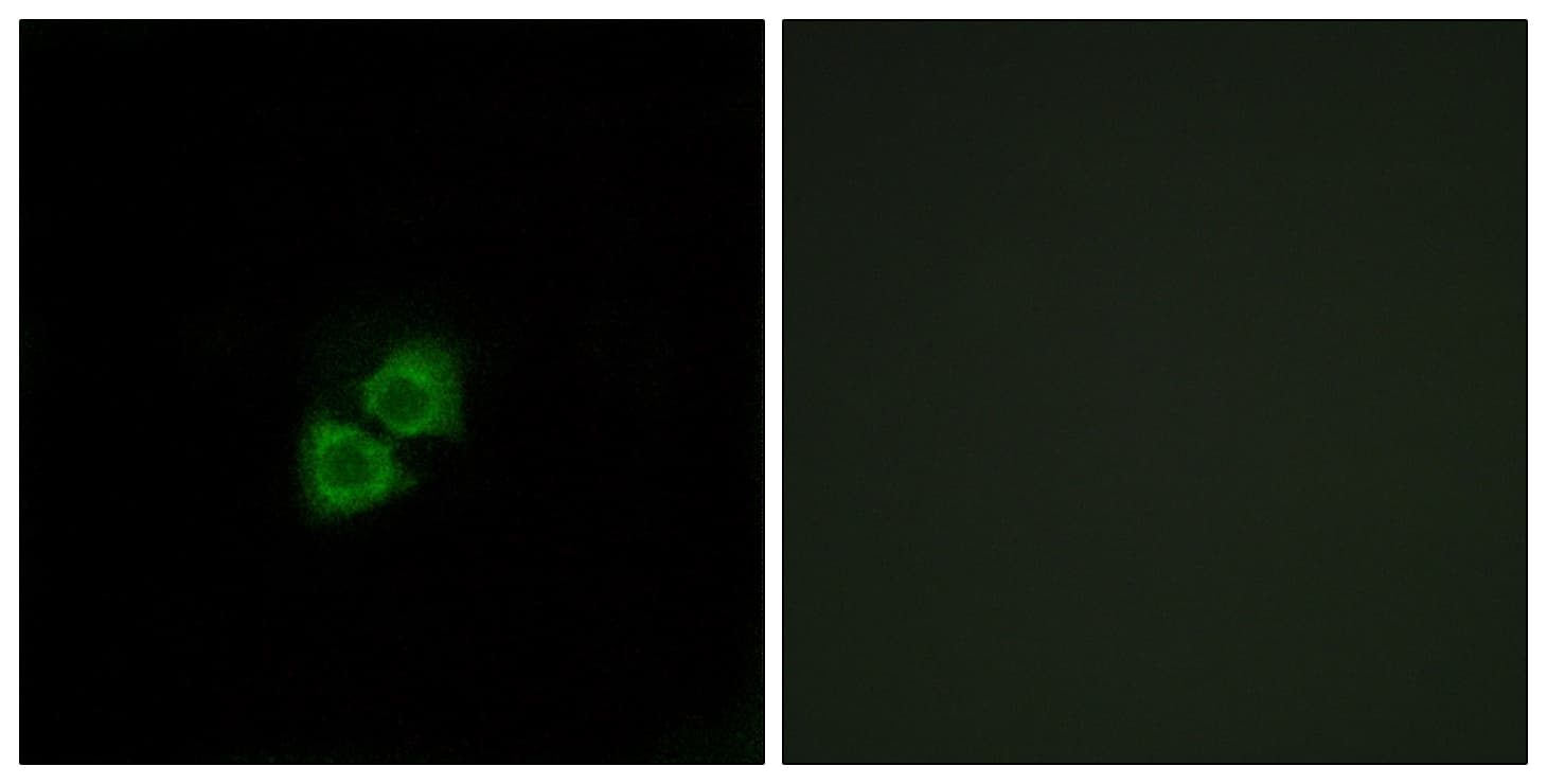 APOA1BP Antibody (aa121-170)