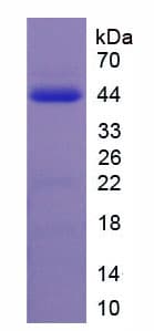 Rat GAL / Galanin Protein (Recombinant His-GST)