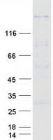 Human SSFA2 Protein (Recombinant Myc-DDK (Flag))