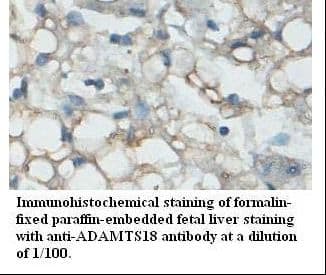 ADAMTS18 Antibody