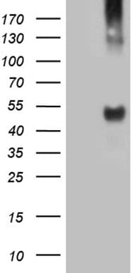 Monoclonal Mouse anti-Human Tyrosine Aminotransferase Antibody (clone OTI3G6, Carrier-free, WB)
