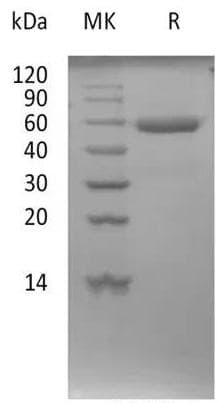 Coronavirus SARS-CoV-2 Spike Glycoprotein (Recombinant mFc, C-terminus)