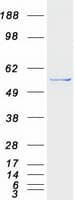Human PI4K2B Protein (Recombinant Myc-DDK (Flag))