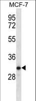 PRSS41 Antibody (aa106-133)