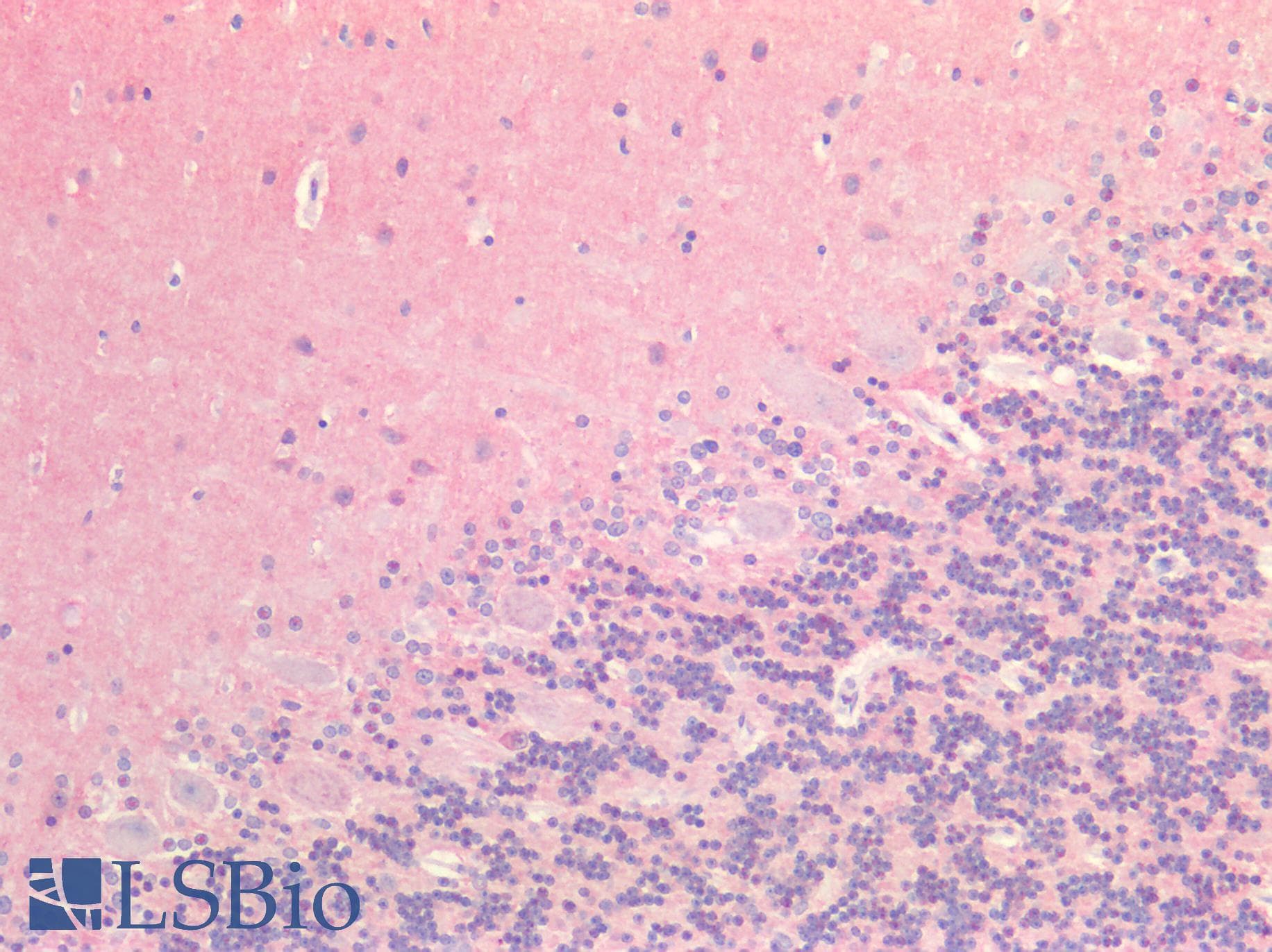 IHC-plus™ MAPT / Tau Antibody