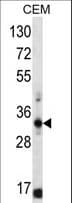 FFAR1 / GPR40 Antibody (aa275-300)