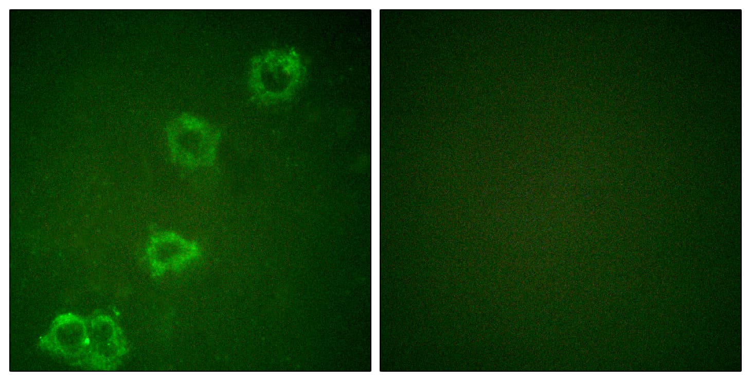 BACE1 / BACE Antibody (aa452-501)