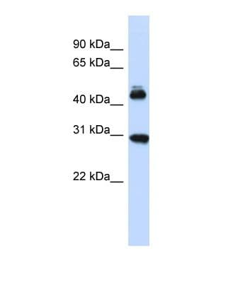 CBX4 Antibody (aa31-80)
