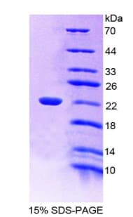Pig LGB / Beta-Lactoglobulin Protein (Recombinant His-T7)