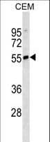 IgD Heavy Chain Antibody (aa37-64)