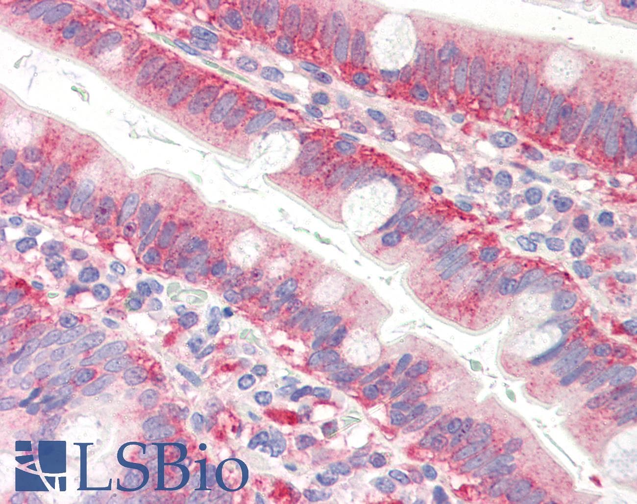 IHC-plus™ Monoclonal Mouse anti-Human CFL1 / Cofilin Antibody (clone AT1C1, aa1-166, IHC, WB)