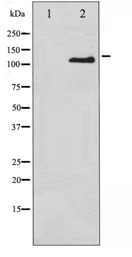 ITGB3 / Integrin Beta 3 / CD61 Antibody (phospho-Tyr785)