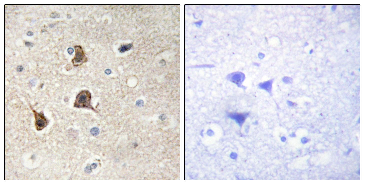 Basigin / Emmprin / CD147 Antibody