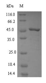 Human FDFT1 / Squalene Synthase Protein (Recombinant 6His, N-terminus)