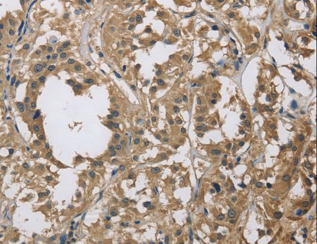 IHC-plus™ DSG2 / Desmoglein 2 Antibody