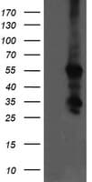 CCT8L2 Antibody (clone OTI4A4)