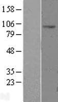 Human CLCN2 Protein (Over-Expression Lysate Myc-DDK (Flag))