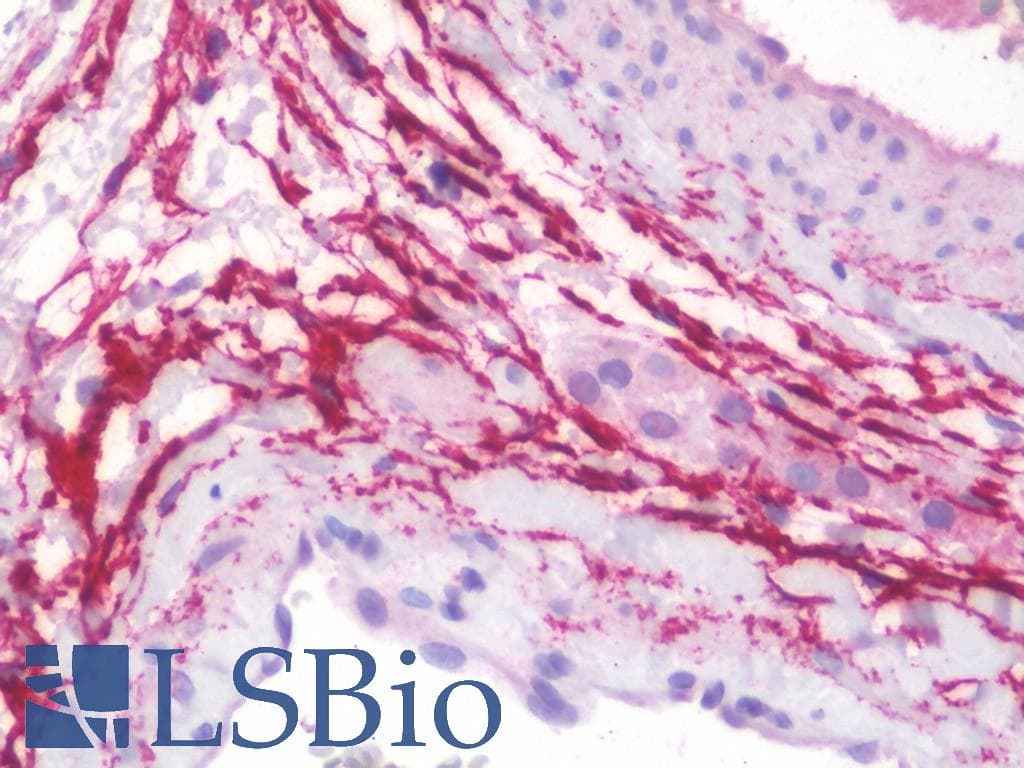 IHC-plus™ Fibulin-3 / EFEMP1 Antibody (clone 1D9)