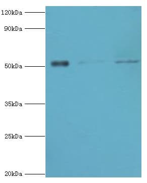 Polyclonal Rabbit anti-Human BAG5 Antibody (aa198-447, IHC, WB)