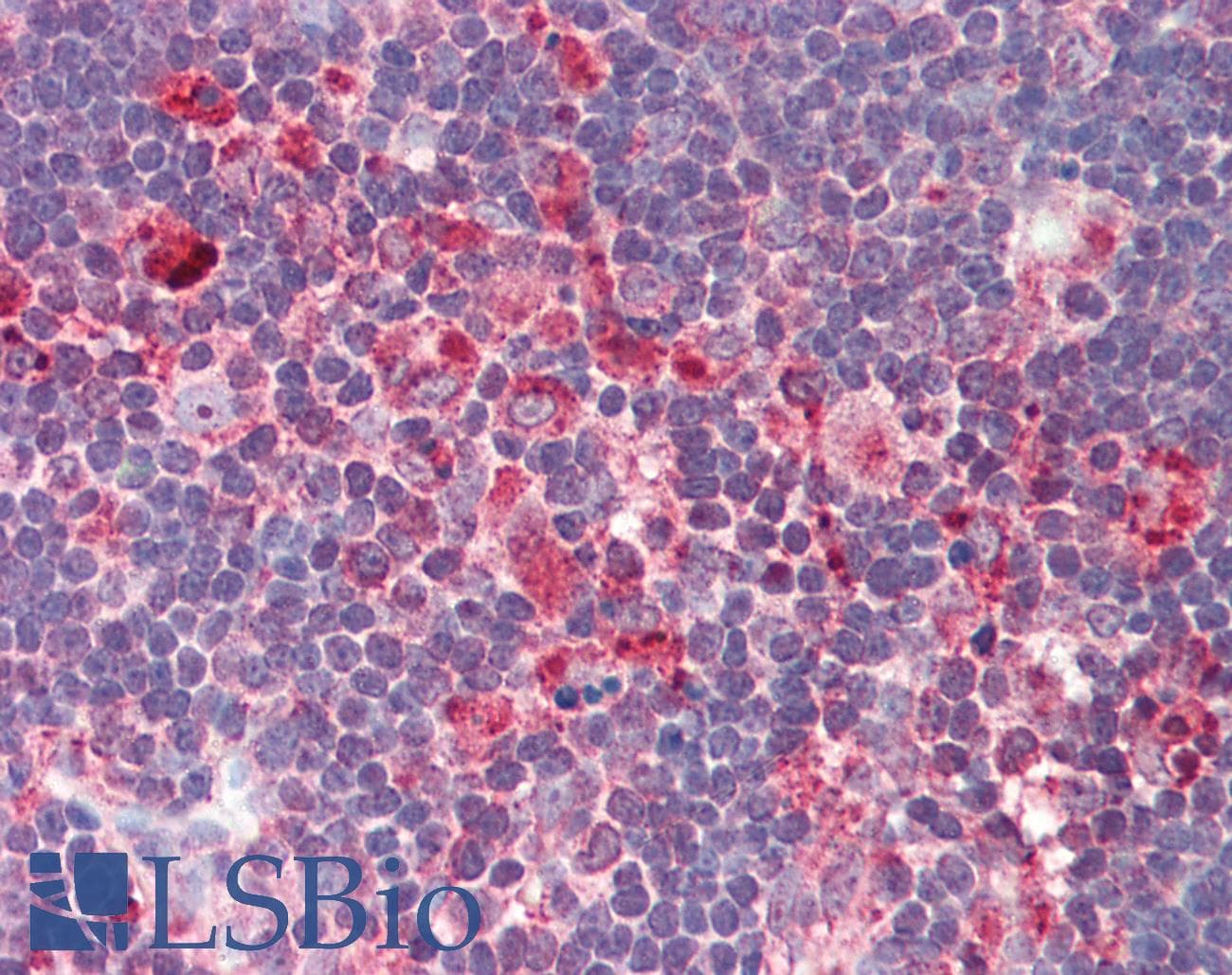 IHC-plus™ IL32 Antibody