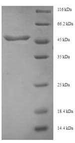 Human TGFB3 / TGF Beta3 Protein (Recombinant 6His-SUMO, N-terminus)