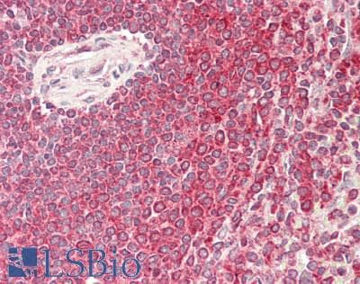 IHC-plus™ NSD3 / WHSC1L1 Antibody