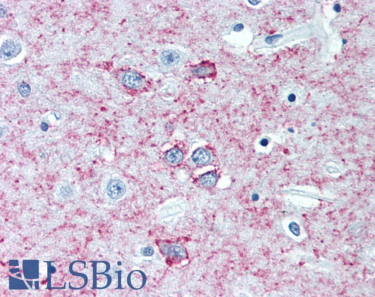 PathPlus™ ADORA2A/Adenosine A2A Receptor Antibody (3rd Intracellular Domain, clone 7F6-G5-A2 / 7F6)