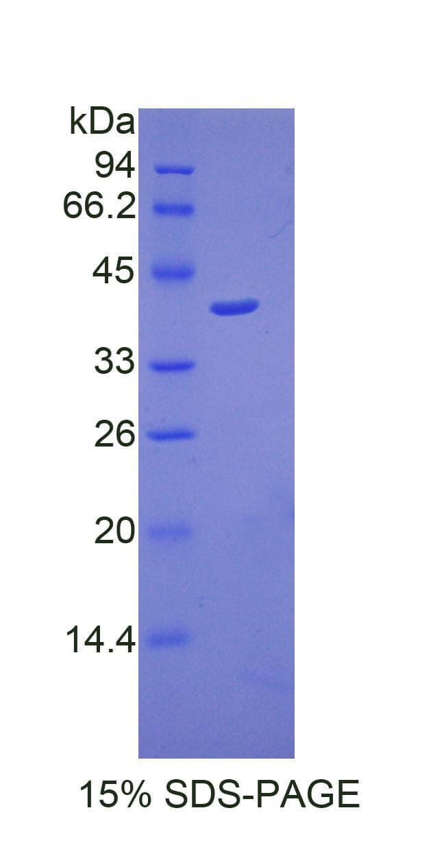 Mouse CTSD / Cathepsin D Protein (Recombinant His)