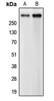 CEP290 Antibody (Internal)
