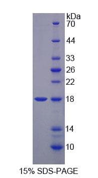 Mouse MARS Protein (Recombinant His-T7, N-terminus)